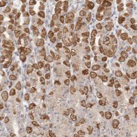 Anti-USP24 antibody produced in rabbit HPA028428-100UL