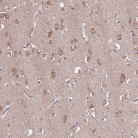 Anti-USP32 antibody produced in rabbit 