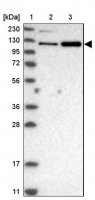Anti-USP47 antibody produced in rabbit