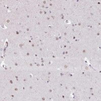 Anti-UTP18 antibody produced in rabbit HPA052378-100UL