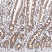 Anti-VIPAS39 antibody produced in rabbit 