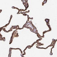 Anti-VIPR2 antibody produced in rabbit 