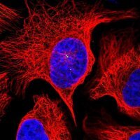 Anti-VPS25 antibody produced in rabbit 