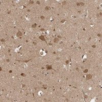 Anti-VPS50 antibody produced in rabbit 