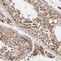 Anti-VPS50 antibody produced in rabbit 
