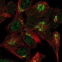 Anti-VPS54 antibody produced in rabbit HPA070582-100UL