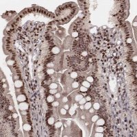 Anti-VRK3 antibody produced in rabbit