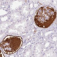 Anti-VTN antibody produced in rabbit 