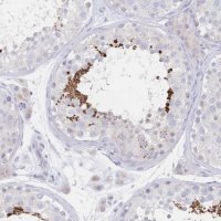 Anti-VWC2L antibody produced in rabbit 