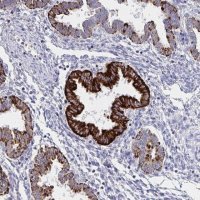 Anti-VWDE antibody produced in rabbit 