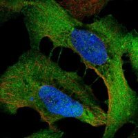 Anti-WDR1 antibody produced in rabbit 