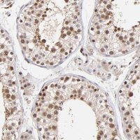 Anti-WDR25 antibody produced in rabbit HPA003113-100UL