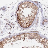 Anti-WDR41 antibody produced in rabbit 