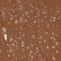 Anti-WDR41 antibody produced in rabbit 