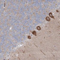 Anti-WDR49 antibody produced in rabbit 