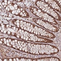 Anti-WDR55 antibody produced in rabbit 
