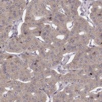 Anti-WDR59 antibody produced in rabbit HPA048218-100UL