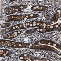 Anti-WDR60 antibody produced in rabbit 
