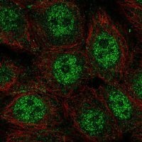 Anti-WDYHV1 antibody produced in rabbit 