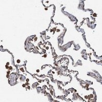 Anti-WIF1 antibody produced in rabbit 