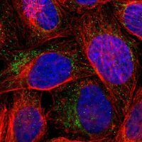 Anti-WSB1 antibody produced in rabbit 