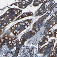 Anti-WSCD2 antibody produced in rabbit HPA013346-100UL