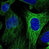Anti-WWC2 antibody produced in rabbit