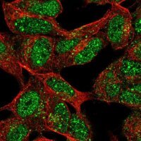 Anti-XRCC2 antibody produced in rabbit 