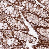 Anti-XRN2 antibody produced in rabbit 