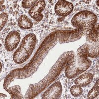 Anti-XYLB antibody produced in rabbit