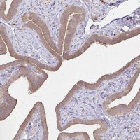 Anti-YAP1 antibody produced in rabbit 