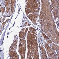 Anti-YEATS2 antibody produced in rabbit 
