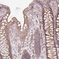 Anti-YIF1B antibody produced in rabbit 