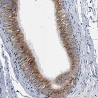 Anti-YIPF6 antibody produced in rabbit 