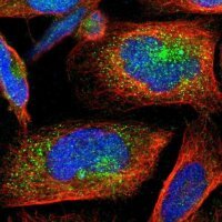 Anti-YIPF6 antibody produced in rabbit 