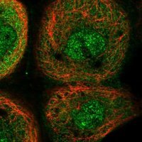 Anti-YOD1 antibody produced in rabbit 
