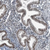 Anti-YTHDC1 antibody produced in rabbit 