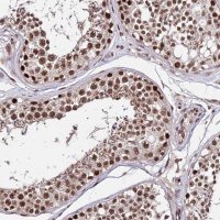 Anti-ZBED4 antibody produced in rabbit HPA045341-100UL