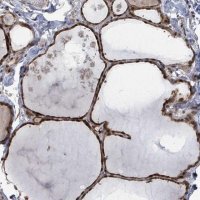 Anti-ZBTB14 antibody produced in rabbit 