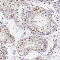 Anti-ZBTB16 antibody produced in rabbit 