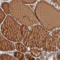 Anti-ZBTB2 antibody produced in rabbit 