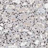 Anti-ZBTB20 antibody produced in rabbit 