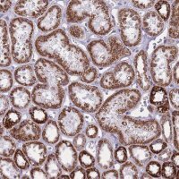 Anti-ZBTB24 antibody produced in rabbit 