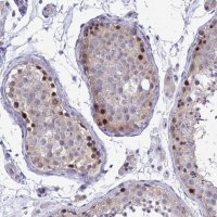 Anti-ZBTB25 antibody produced in rabbit 