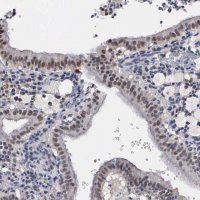 Anti-ZBTB33 antibody produced in rabbit 