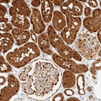 Anti-ZBTB37 antibody produced in rabbit 