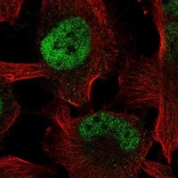 Anti-ZBTB38 antibody produced in rabbit 