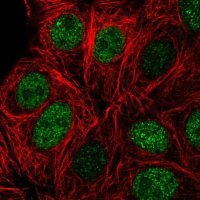 Anti-ZBTB42 antibody produced in rabbit 