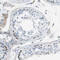 Anti-ZBTB43 antibody produced in rabbit 