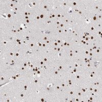 Anti-ZBTB49 antibody produced in rabbit 